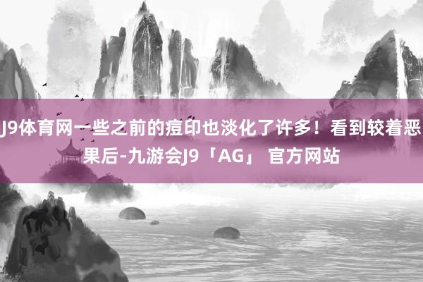 J9体育网一些之前的痘印也淡化了许多！看到较着恶果后-九游会J9「AG」 官方网站